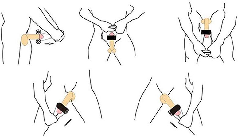 Jelqing is a massage technique for self-enlargement of the penis. 